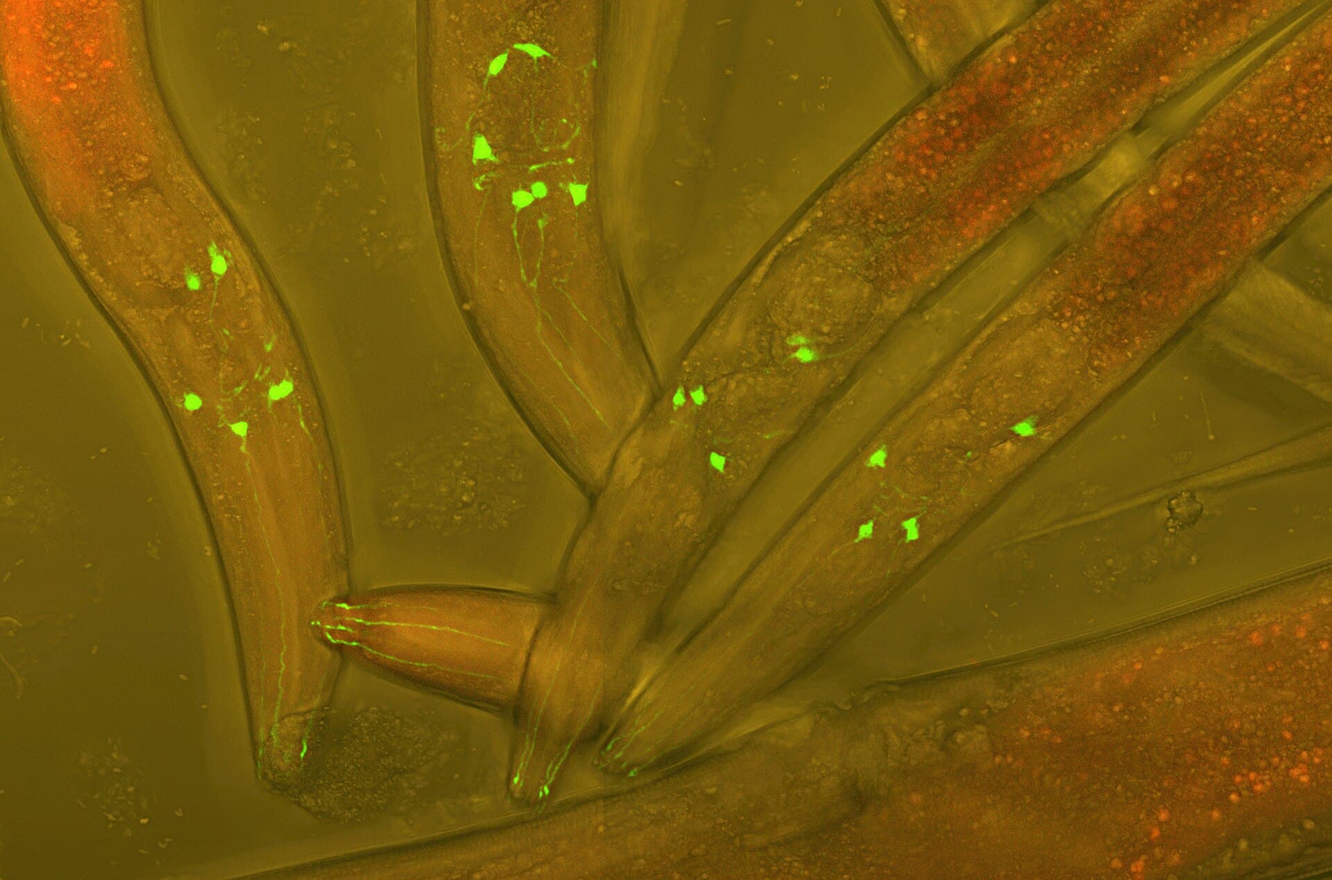 Living Caenorhabditis elegans worm with green fluorescent protein labeling neurons, differential interference contrast micrograph