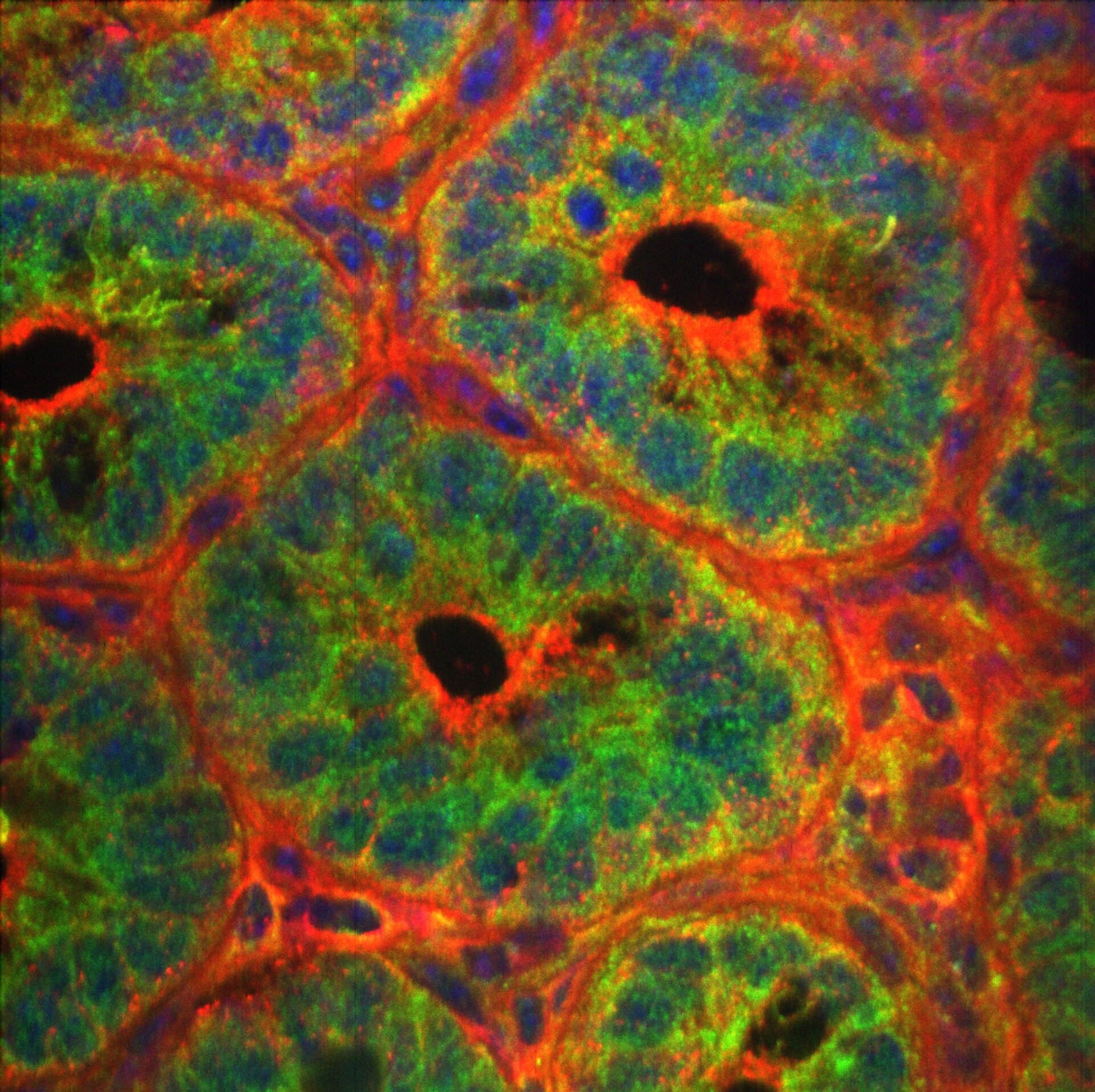 Confocal microscopy of autophagy in mouse intestine tissue