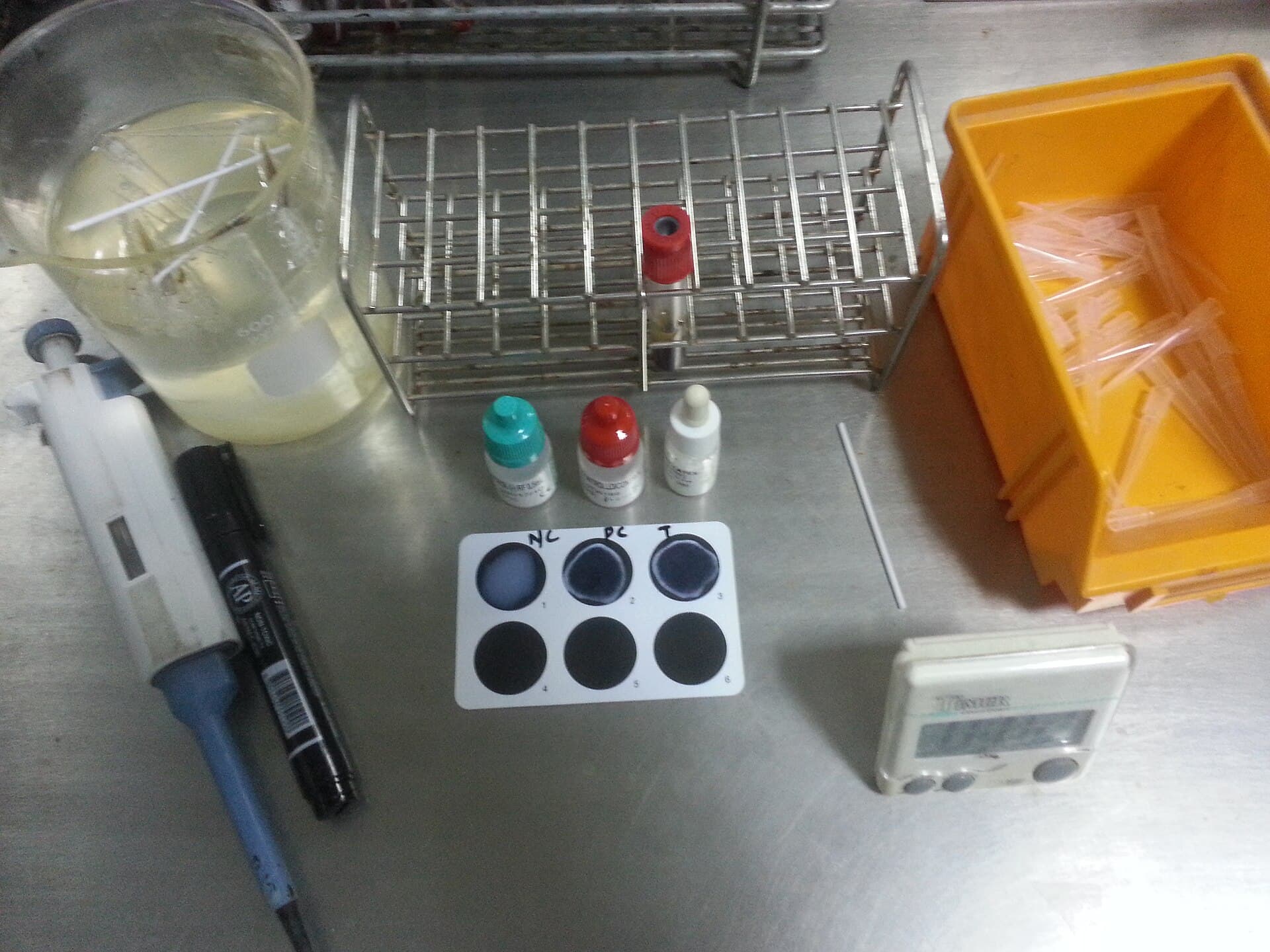 A C-reactive protein (CRP) blood test used to measure inflammation levels